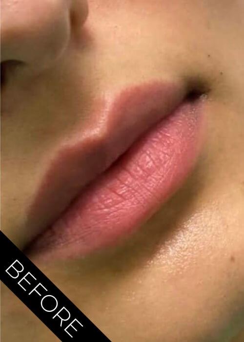 Before Lips