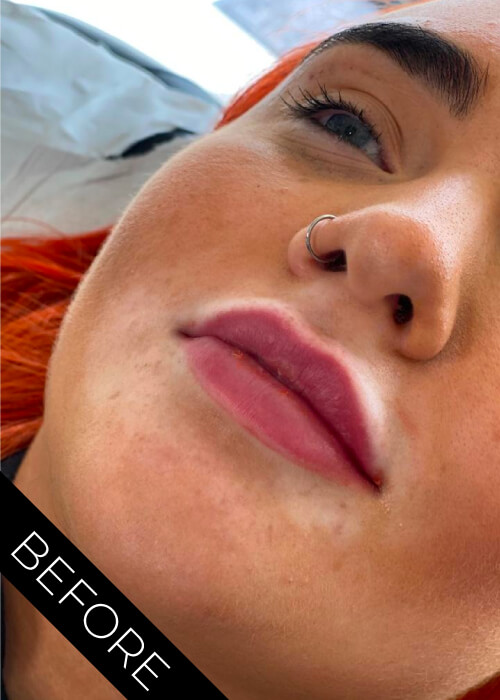 Before Lips
