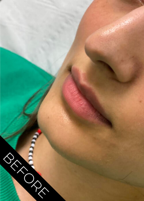 Before Lips